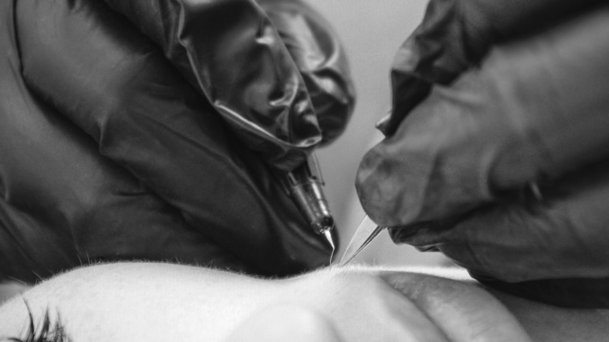 Protocole Geste de l'&eacute;pilation par &eacute;lectrolyse Annecy