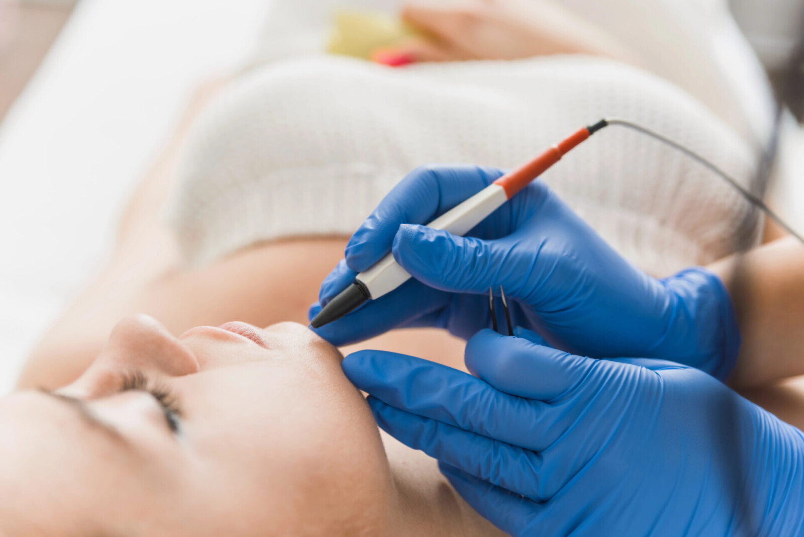 Epilation définitive par électrolyse à Annecy