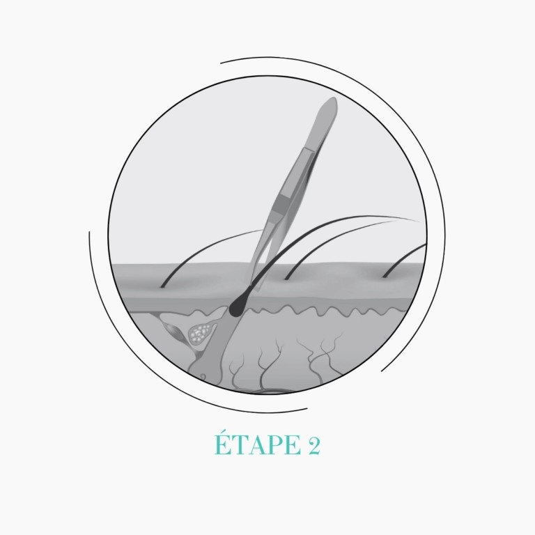 Etape 2 &eacute;pilation par &eacute;lectrolyse &agrave; Annecy